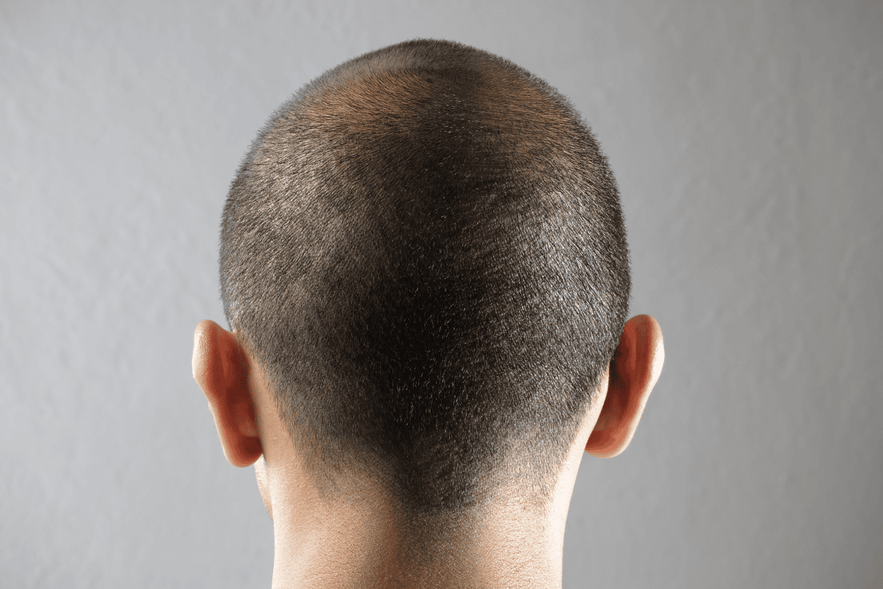 zona donante zona donante