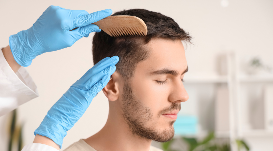 ¿Cuál es la mejor edad para un injerto capilar?