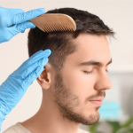 ¿Cuál es la mejor edad para un injerto capilar