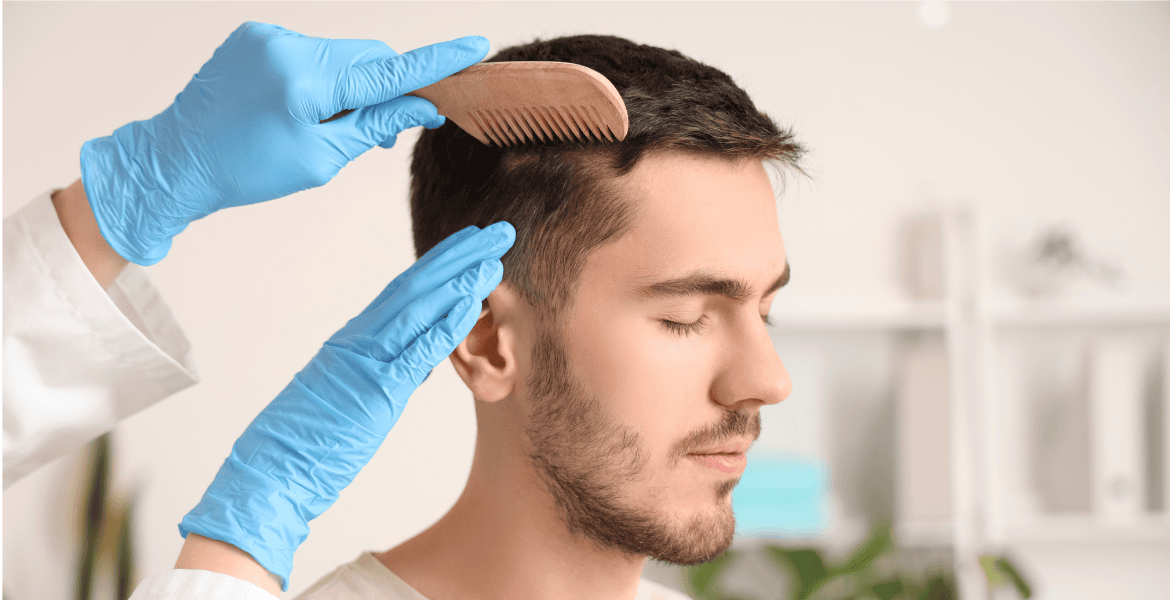 ¿Cuál es la mejor edad para un injerto capilar ¿Cuál es la mejor edad para un injerto capilar