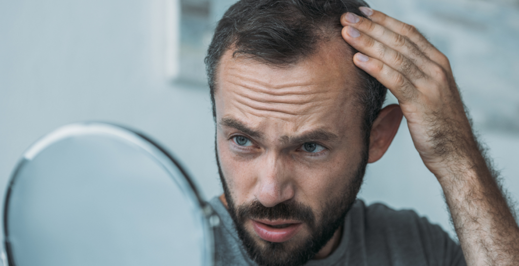 ¿Cuándo puedo volver a hacer ejercicio tras un injerto capilar (2)